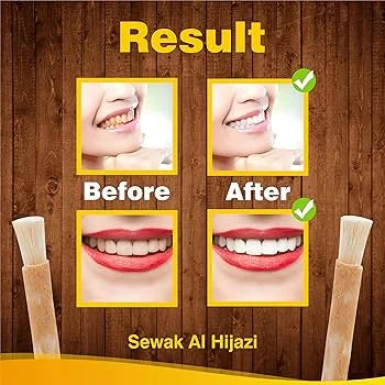 Miswak - Premium  from Sewak Al Hijazi - Just €0.25! Shop now at Islamic Wholesale